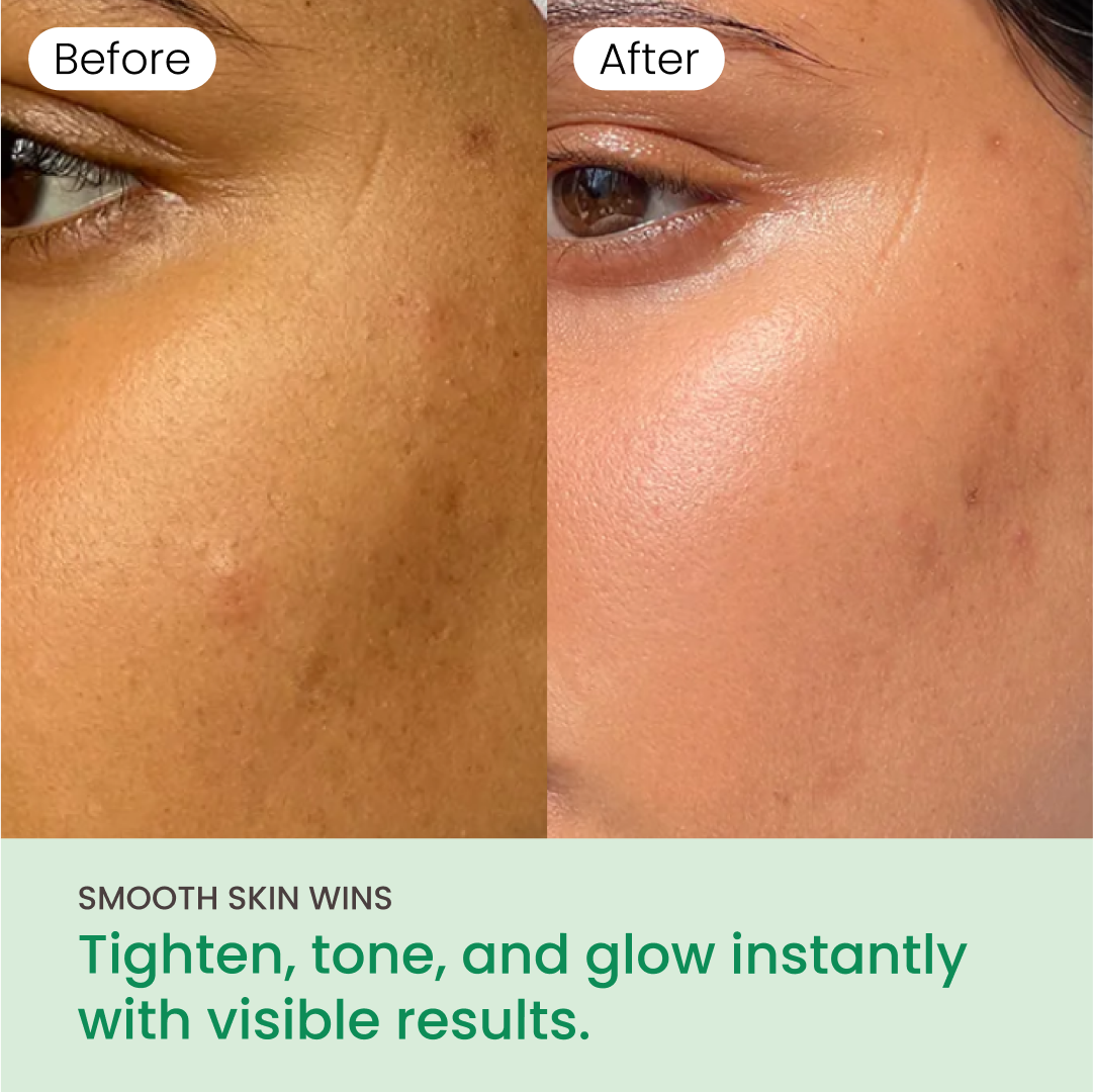 QUIA Toner Pads – AHA/BHA Dual-Action Exfoliate and Hydrate All in One – Soothing Formula for Sensitive Skin – Reduces Blackheads and Blemishes- 70 Gentle Textured Pads – Korean Skincare