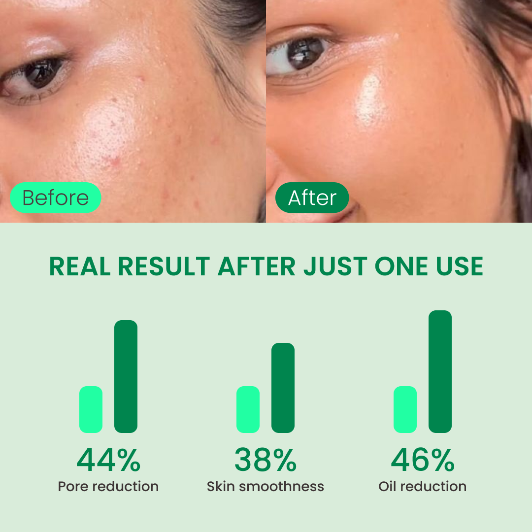 QUIA Toner Pads – AHA/BHA Dual-Action Exfoliate and Hydrate All in One – Soothing Formula for Sensitive Skin – Reduces Blackheads and Blemishes- 70 Gentle Textured Pads – Korean Skincare