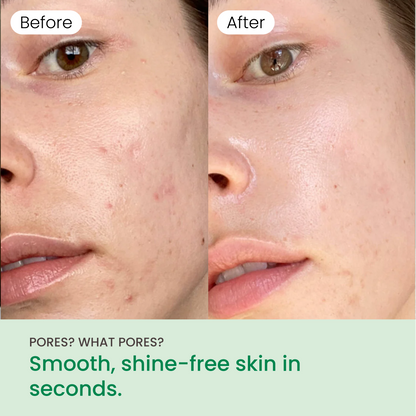 QUIA Toner Pads – AHA/BHA Dual-Action Exfoliate and Hydrate All in One – Soothing Formula for Sensitive Skin – Reduces Blackheads and Blemishes- 70 Gentle Textured Pads – Korean Skincare